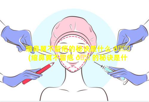 缩鼻翼不留疤的秘诀是什么 🐅 (缩鼻翼不留疤 🦅 的秘诀是什么图片)